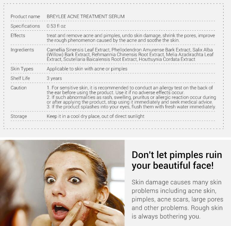 Acne Treatment Serum Facial Repair Oil Acne Treatment Serum Facial Repair Oil